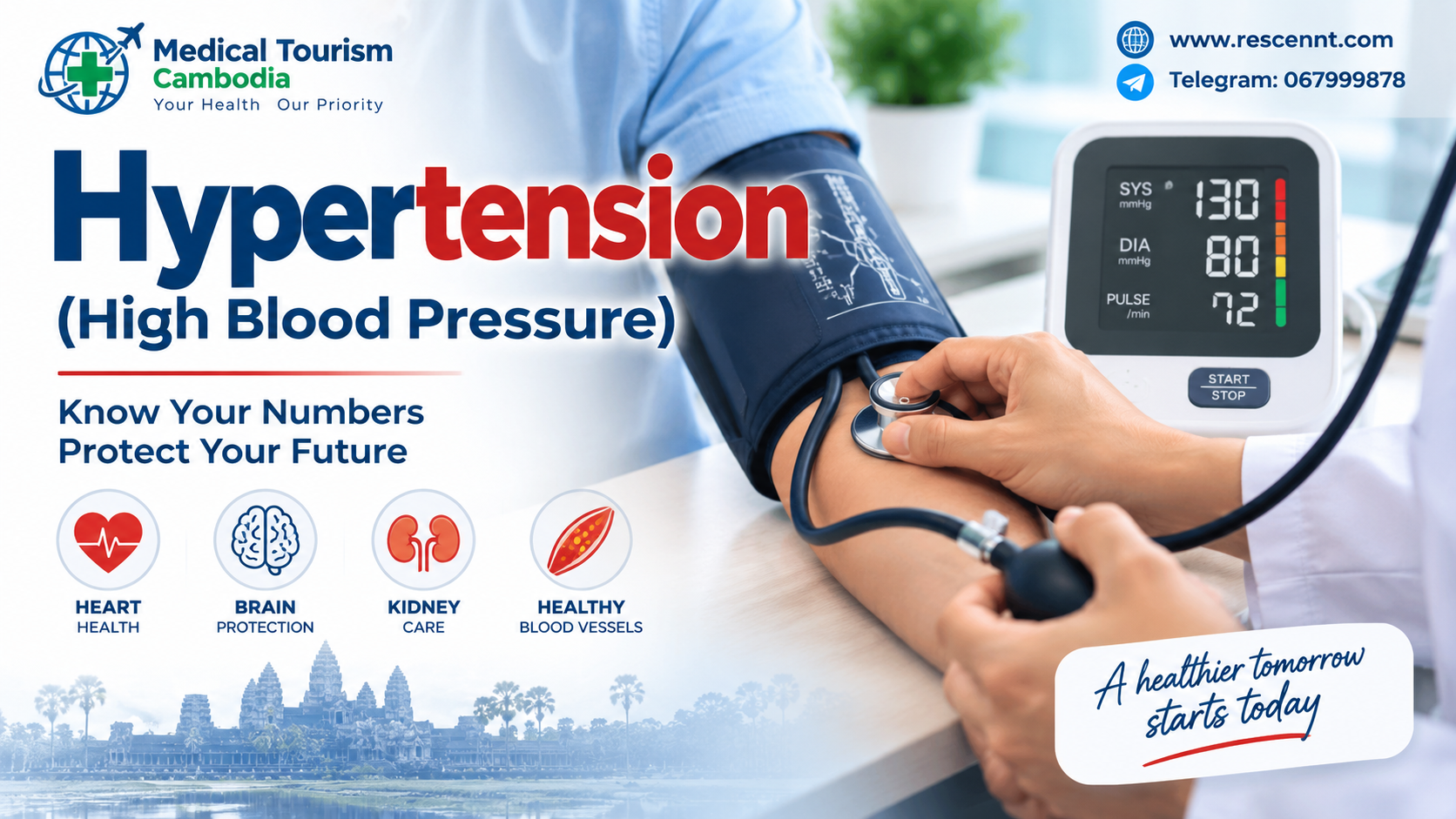 Hypertension (High Blood Pressure): Causes, Symptoms, Diagnosis, and Treatment